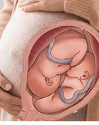 Twin Pregnancy Care